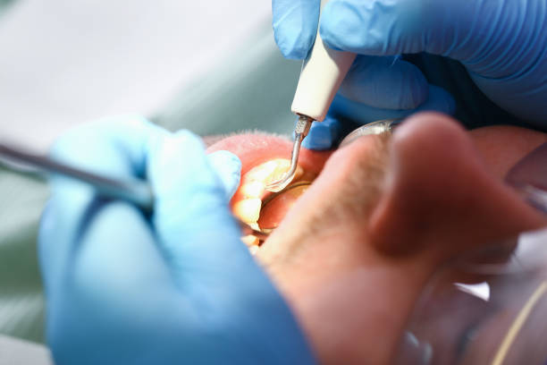 Best Emergency Treatment for Toothache in Abingdon, IL