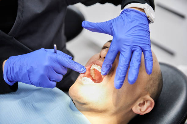 Best Emergency Tooth Extraction in Abingdon, IL